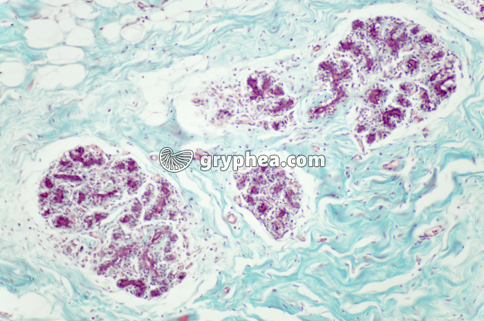 Glande mammaire x40 - gryphea.com